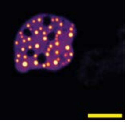 TRIM8-RBBC–FUS IDR nuclear microscopy source panel with embedded scale bar